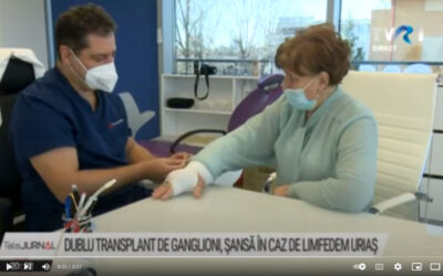 Premieră în România. Dublu transplant de ganglioni, șansă pentru o femeie care avea limfedem uriaș la un braț